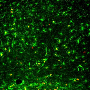 Proliferating microglia in prion (from Gomez-Nicola et al., J Neurosci 2013)     